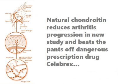 how chondroitin works