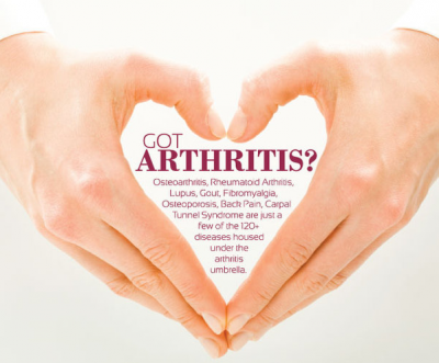 natural treatment of arthritis