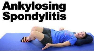 ankylosing spondylitis exercises