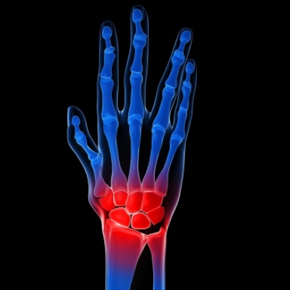 arthritis in wrist treatment
