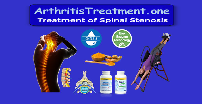 Natural Treatment for Spinal Stenosis