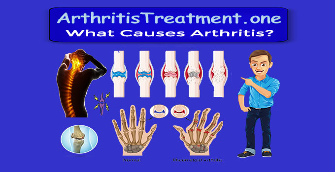 Cause of Arthritis